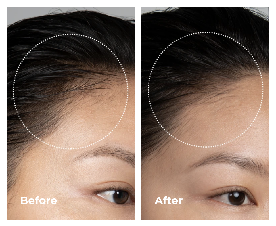 Máy massage chăm sóc da đầu Foreo Luna 4 Hair