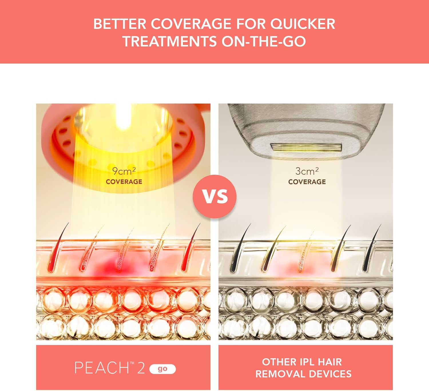 Máy triệt lông Foreo Peach 2 Go