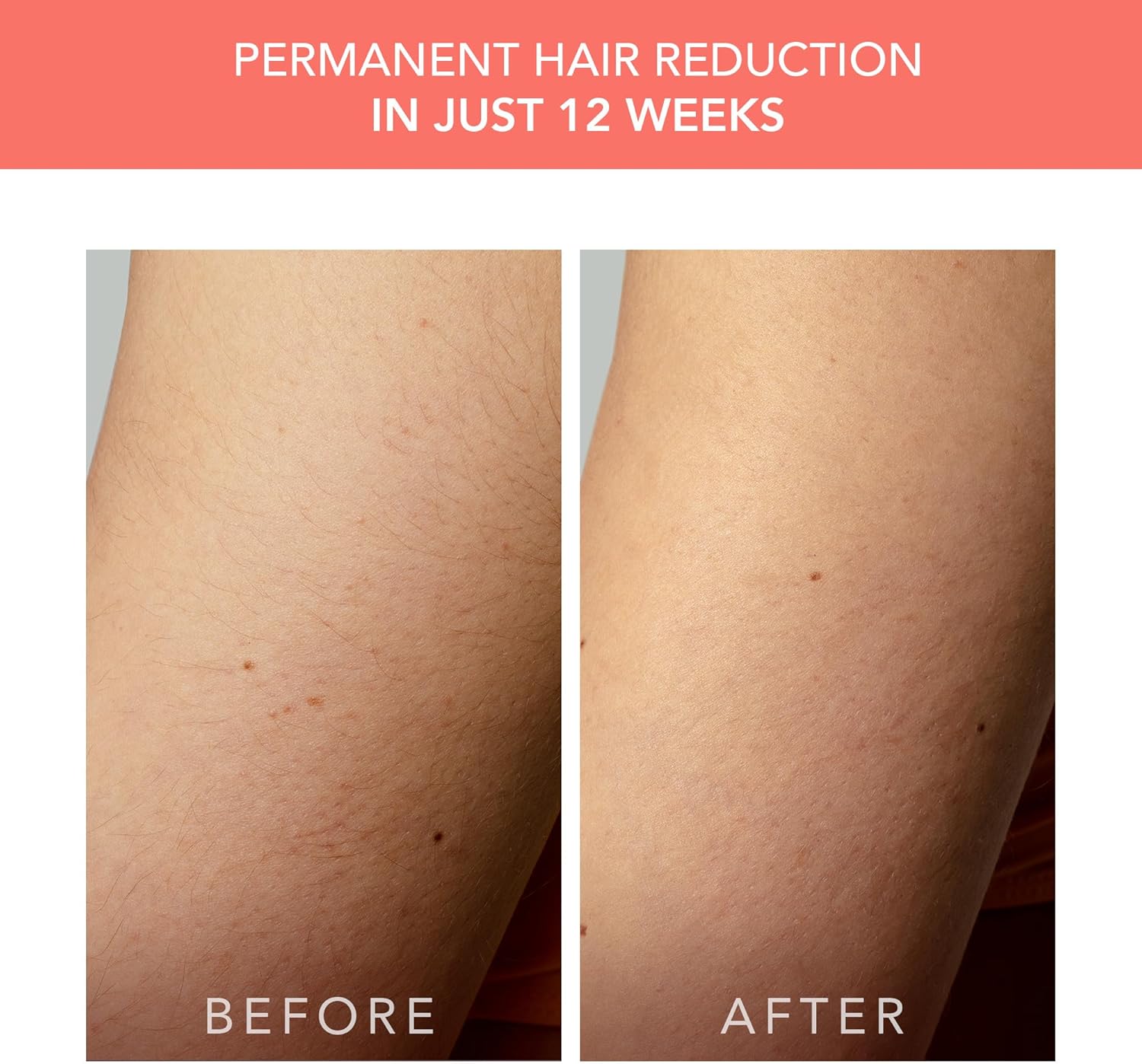 Máy triệt lông Foreo Peach 2 Go