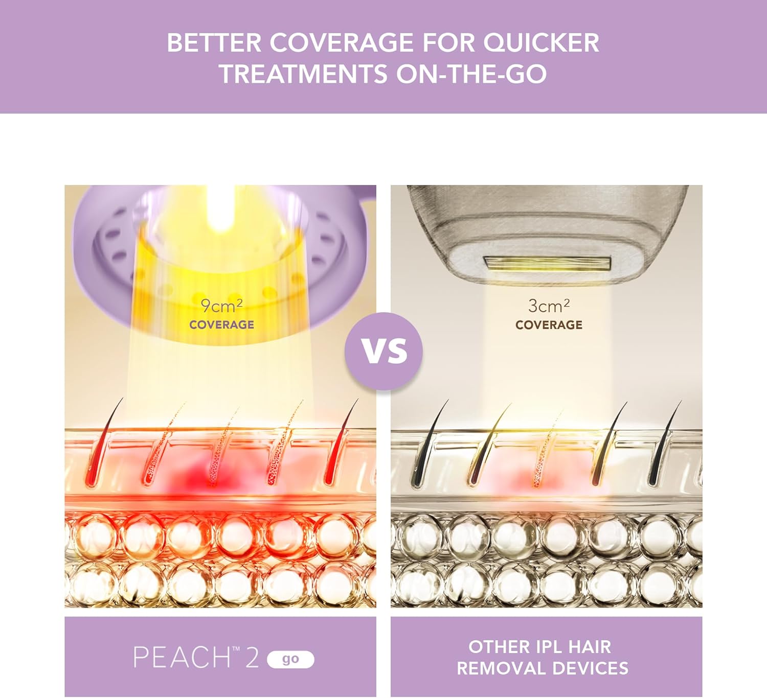 Máy triệt lông Foreo Peach 2 Go