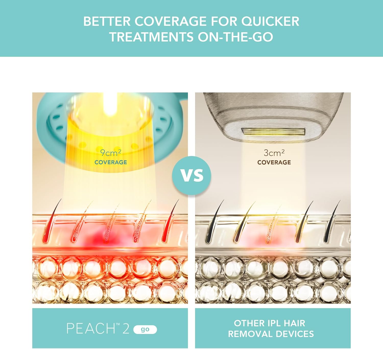 Máy triệt lông Foreo Peach 2 Go