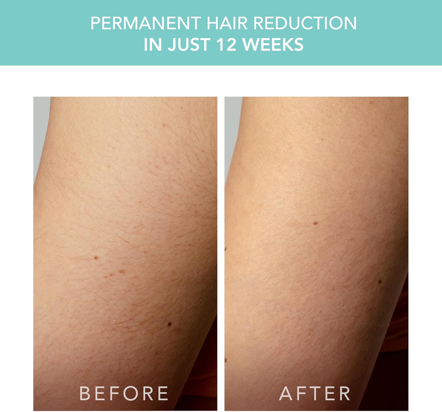 Máy triệt lông Foreo Peach 2 Go