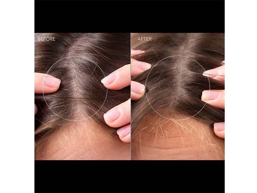Máy kích thích mọc tóc Foreo FAQ™ 302