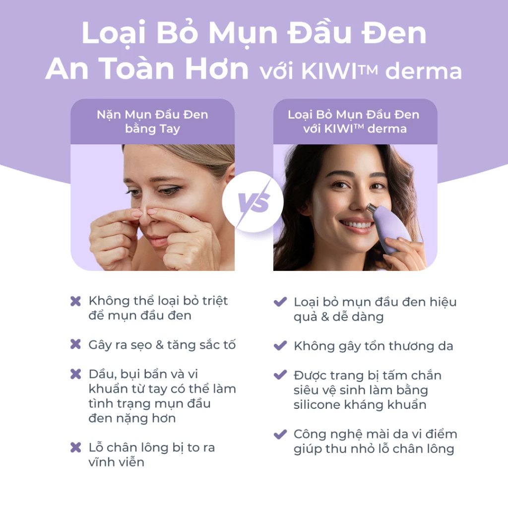 Máy mài da vi điểm, hút mụn Foreo KIWI Derma