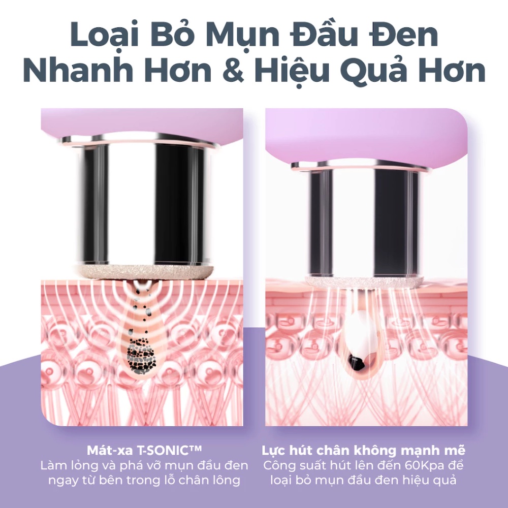 Máy mài da vi điểm, hút mụn Foreo KIWI Derma