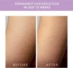 Máy triệt lông Foreo Peach 2 Go