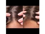 Máy kích thích mọc tóc Foreo FAQ™ 302