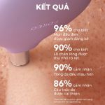 Máy mài da vi điểm, hút mụn Foreo KIWI Derma